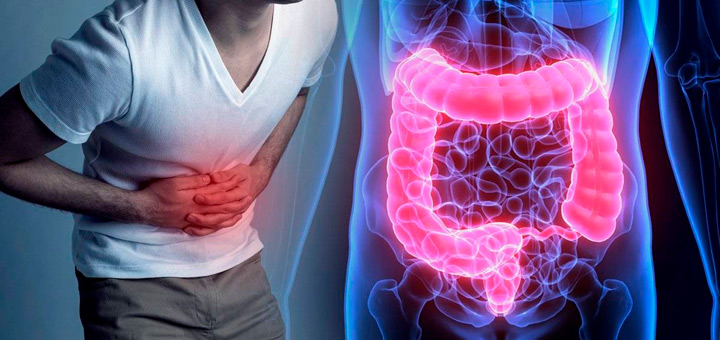 inflamatoria intestina
