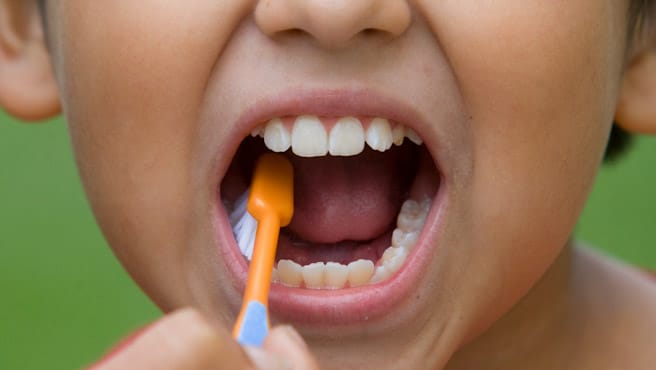 Higiene bucal temprana: prevención desde el inicio
