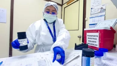 Los laboratorios de referencia nacional en La Paz y Santa Cruz podrían analizar hasta 1.000 muestras sospechosas de sarampión por día,